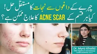 Dr. Myra Shares Top Acne Scar Treatments That Actually Work! | Cosmetique