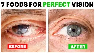How to Improve Eyesight Naturally ? 7 Foods For Perfect Vision (Eye Health)