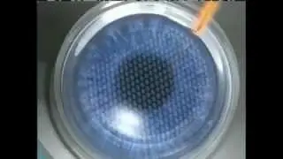 IntraLase Laser