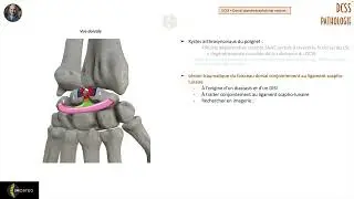 Imagerie des pathologies du DCSS