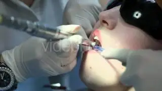 Dentist Of Patient Young Girl Open Mouth During Oral Checkup - Stock Footage | VideoHive 14589306