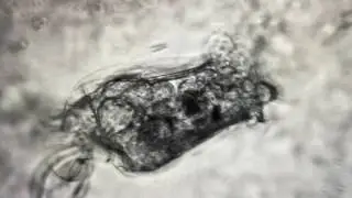 Bdelloidea rotifer from 1502 Alice St, Oakland