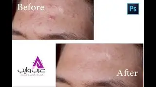 شرح إزالة الحبوب من الوجه باستخدام الفوتوشوب