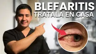 ✅ Tratamiento CASERO para la BLEFARITIS (3 PASOS)