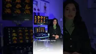 - homila suvining kamayishiga nima sabab bo&rsquo;ladi?- homila suvi kamayishi nimaga olib keladi?