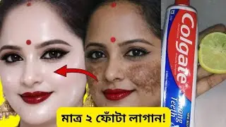 মাত্র দু ফোটা লাগাও মুখ আয়নার মতো জ্বলজ্বল করতে শুরু করবে পুরনো দাগ কালো দাগ সব পরিষ্কার হবে/Skin