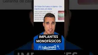 La verdad sobre los IMPLANTES DENTALES MONOF&Aacute;SICOS o MONOBLOCK - &iquest;Sin hueso y sin cirug&iacute;a?