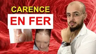 CARENCE EN FER : Les 3 Grandes Causes