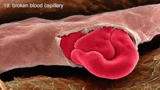 30 amazing electron microscopic images   micro universe   YouTube