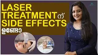 🩺 ലേസർ ചികിത്സക്ക് മുൻപ് ഈ കാര്യങ്ങൾ അറിഞ്ഞിരിക്കുക Watch THIS Before You Get Any Laser Treatment!