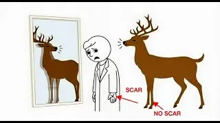 Why Can't We Heal Our Wounds Without Scars?