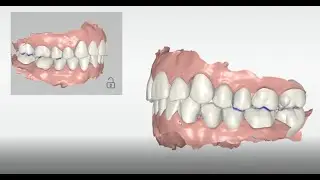 Cerec Ortho 2.0
