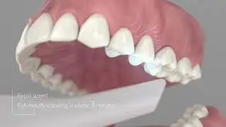 CEDU Intra Oral Scanner OSCAN 1 NEW RELEASE 2025