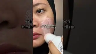Pori pori besar dan minyakan parah harus diapain sihhh? cape bgt punya kulit begini #acneproneskin