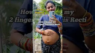 ‼️How I lost 13 Kgs weight after Pregnancy⁉️ Home workouts 💯🔥 #diastisisrecti #postpartumworkout