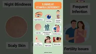 Vitamin A Deficiency: Signs You Should NEVER Ignore | Night Blindness, Hair Loss & More #healthylife