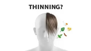 Why Your Hair Is Thinning (And It’s Not Shampoo).