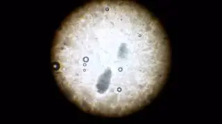Under the Scope: Baker's Yeast