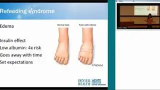 Medical Complications Of Eating Disorders   Silber Lecture Gaudiani 4 27 16 1