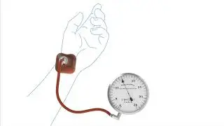 Samuel Siegfried Karl Ritter von Basch sphygmometre