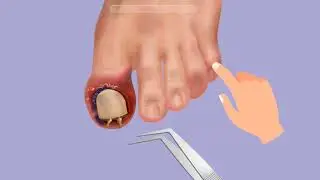 ASMR Hospital Doctor Games #shorts #asmrgame #game