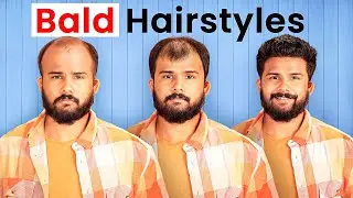 Balding at 22? Try these Hairstyles ( Not Sponsored )