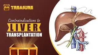 Contraindications to Liver Transplantation by Dr. Santhosh M. Patil  - PrepLadder