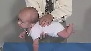 5.9 - Positions, Ventral Suspension - 3 Months - Infant Clinical Examination (MRCP)