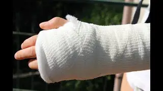 In Your Corner with CORA: Forearm Fractures