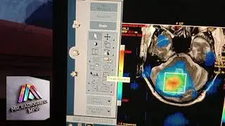 MRI Spectroscopy (MRS) Post processing on GE 1.5T maschin. Full details in Hindi...