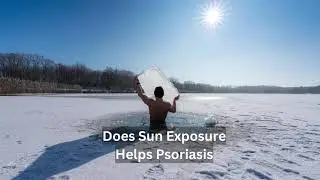 Does Sun Exposure Help Psoriasis