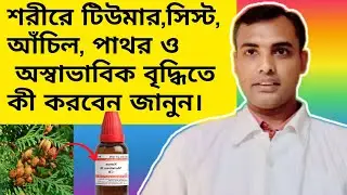Body Tumor cyst warts & abnormal growth | শরীরে অস্বাভাবিক বৃদ্ধিতে কী করবেন জানুন