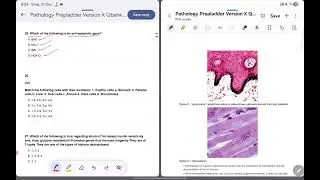 Патология Pyq для fmge 2026 || От Prepladder Q-Bank || #fmge #neetpg #fmge2025 #mbbs #bhfyp #patho