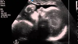 Fae'Lilly Megan Layne.wmv