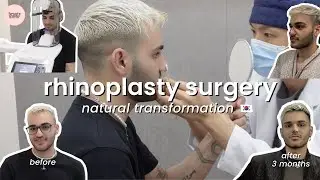 Getting a Nose Job in Korea (ft. Beauty Hopper)