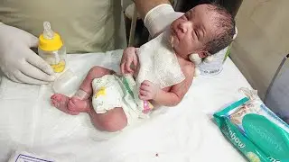 Initial Assessment of LBW Newborn | Poor Sucking | RBS Check & Feeding Trial