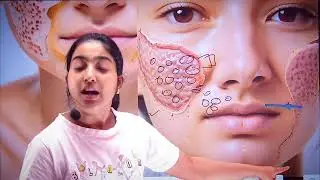 अब Skin की सारी problems होगी खत्म |Alka Thakur|