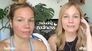 Как я привела в порядок свою кожу! // Мои любимые продукты
