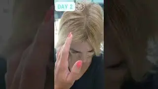 Oil control spray Results