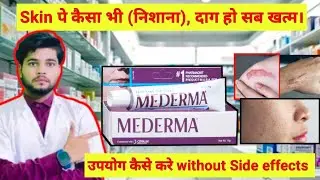 Mederma cream || Mederma for acne scars || Mederma advance scars gel review || Scars 