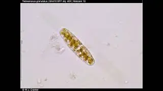 Hydrobiology pics 2, Desmids etc.
