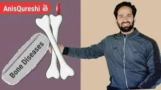 Bone Diseases | Symptoms Precautions And Treatment | By Anis Qureshi
