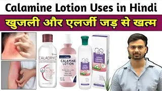 Calamine Lotion | Uses, Benefits & Side Effects in Hindi | Skin Care & Treatment | Midicine