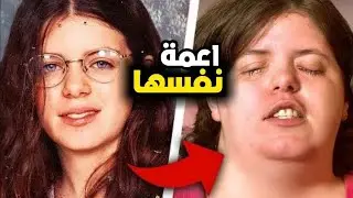 اعمت نفسها لسبب غريب