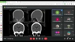 XQuang CT Sọ Não | Chẩn đoán hình ảnh Ctump