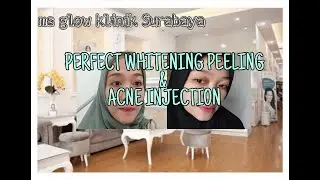 REVIEW TREATMENT DI MS GLOW KLINIK SURABAYA