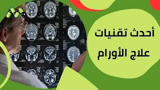 وداعًا للخوف: أورام قاع الجمجمة... علاجات مبتكرة ونتائج مذهلة!