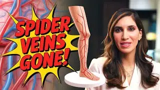 The 6 Stages of Vein Disease (From Spider Veins to Ulcers)