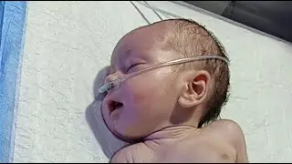 🌸 Premature Baby | NNJ Baby | MMC Baby | Belly Syndrome &ndash; See All in Live NICU Care! 👶💛