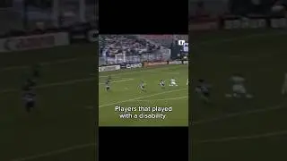 Players that played with a disability 😂 #shorts #viral #football